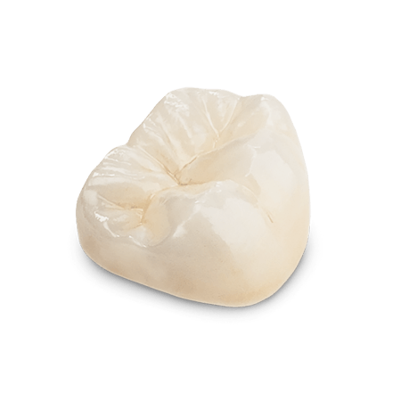 Full-Contour Zirconia