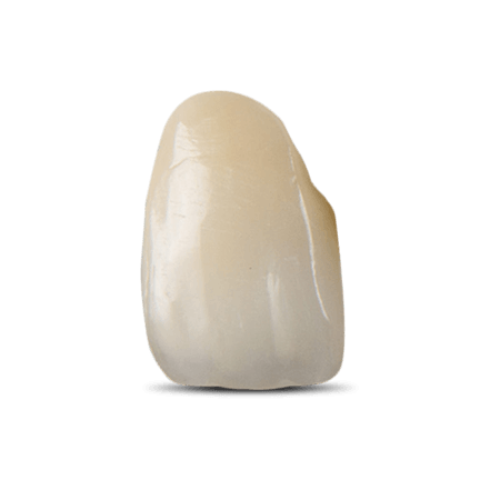 Porcelain-Fused-to-Zirconia